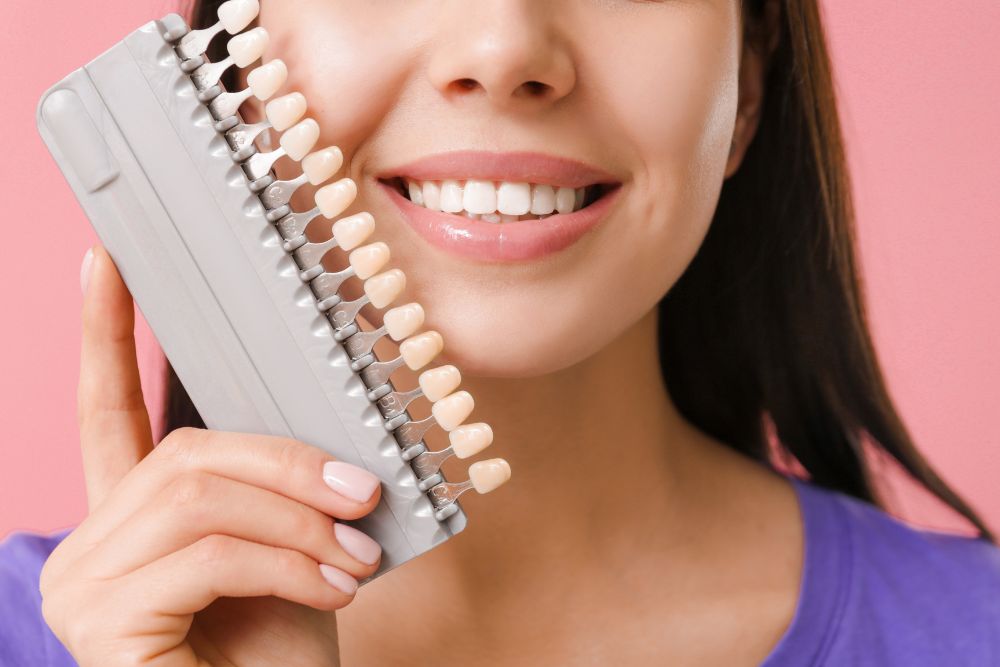 Veneers in Brandon Florida